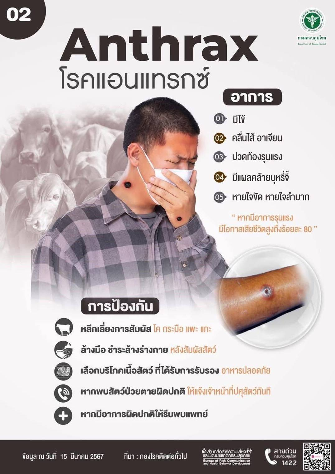 ประชาสัมพันธ์ เรื่องโรคแอนแทรกซ์ (Anthrax)