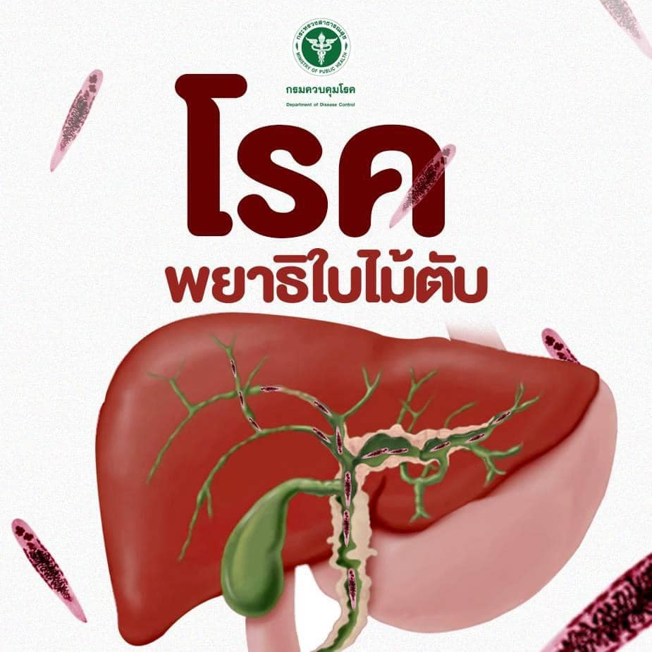 โรคพยาธิใบไม้ตับ (Opisthorchiasis) เกิดจากพยาธิใบไม้ตับ ซึ่งโรคนี้เป็นสาเหตุหลักของโรคมะเร็งท่อน้ำดีในคนไทย
